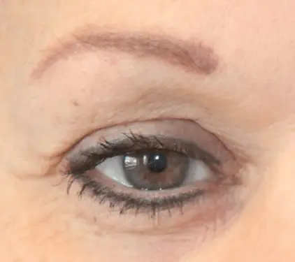 Ein weibliches Auge als Nachherbild nach einer Dermatude Meta Therapy Behandlung ohne Falten