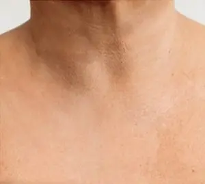 Ein Ausschnitt eines weiblichen Dekolettes als Nachherbild nach einer Dermatude Meta Therapy Behandlung ohne Falten und ohne dunkle Punkten