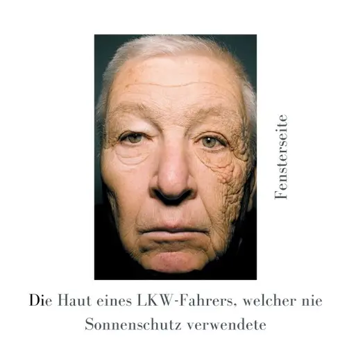Haut eines LKW Fahrers wo die Fensterseite durch die UV Strahlung geschädigt ist