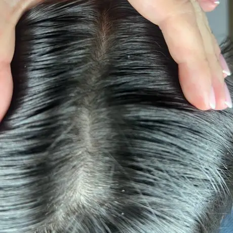 Meta Therapy Haare - weiblicher Kundenkopf mit schwarzen Haaren nach der Behandlung am Scheitel